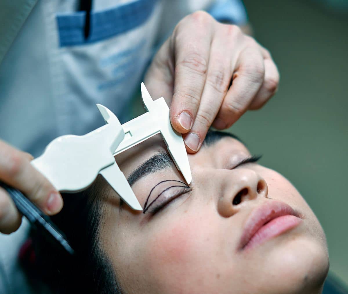 blefaroplastie2