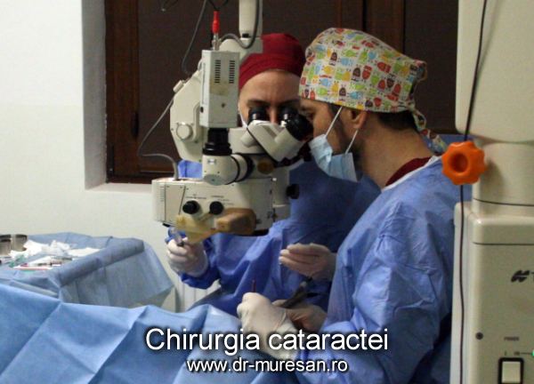 chirurgie de cataracta - detaliu
